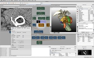 A preview of the MeVisLab editor featuring different modules for visualization and analysis of medical images.